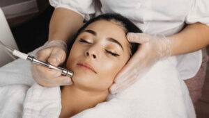 Laser Treatments