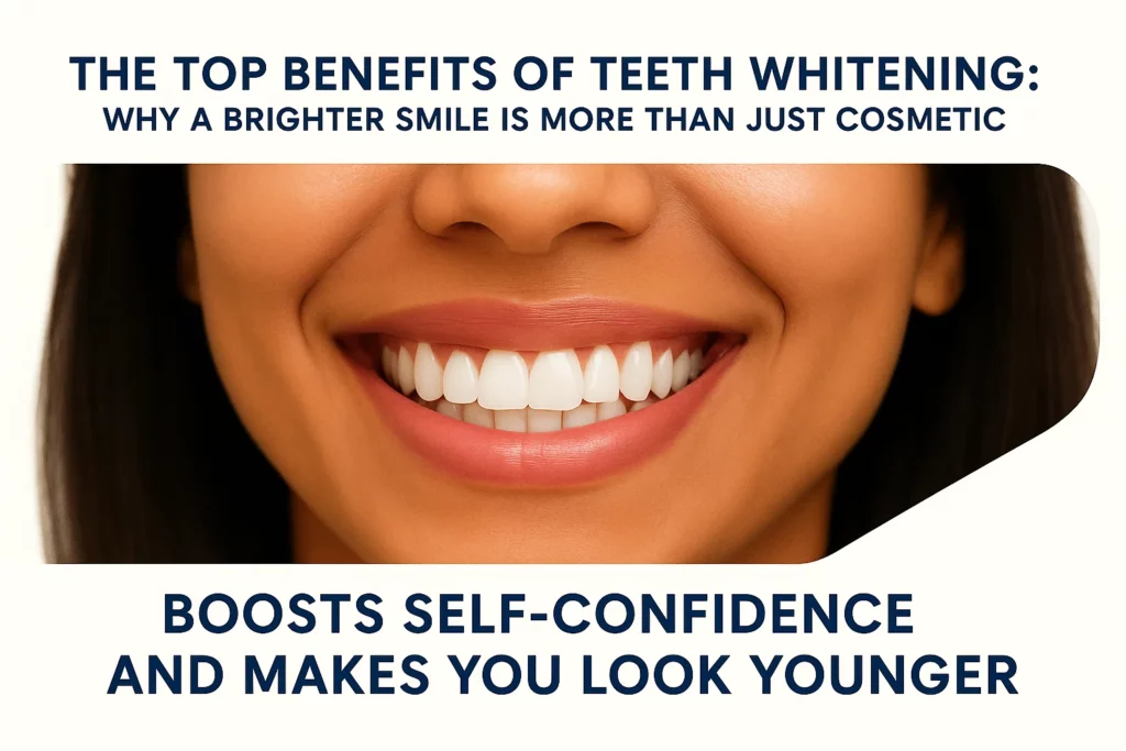 Benefits of Teeth Whitening