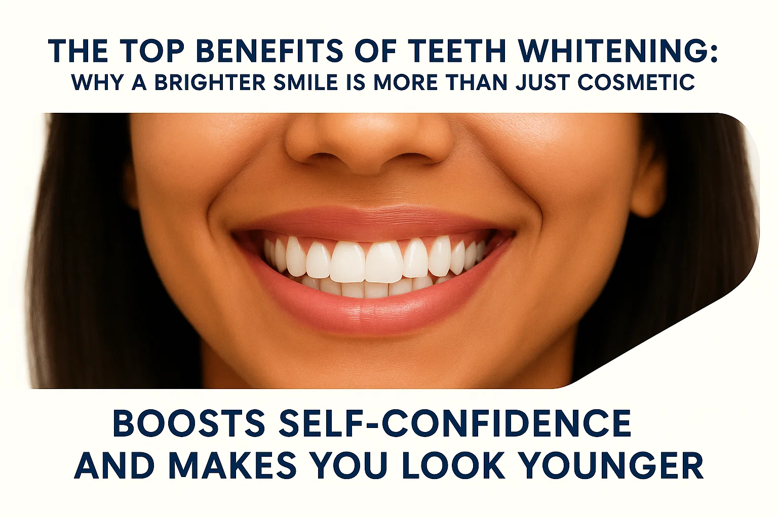Benefits of Teeth Whitening